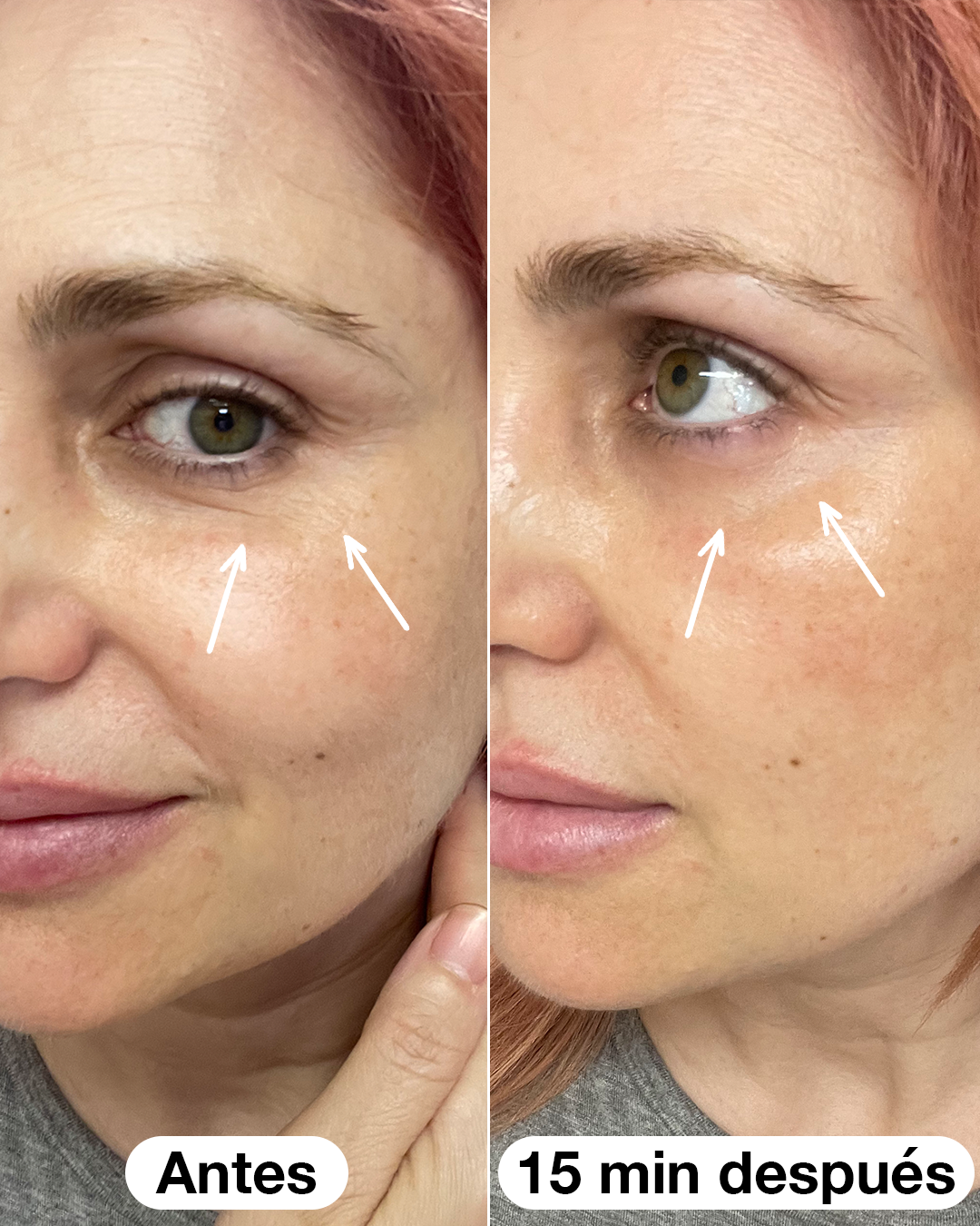 Roll-on Eye Salad Code serum 10 ml