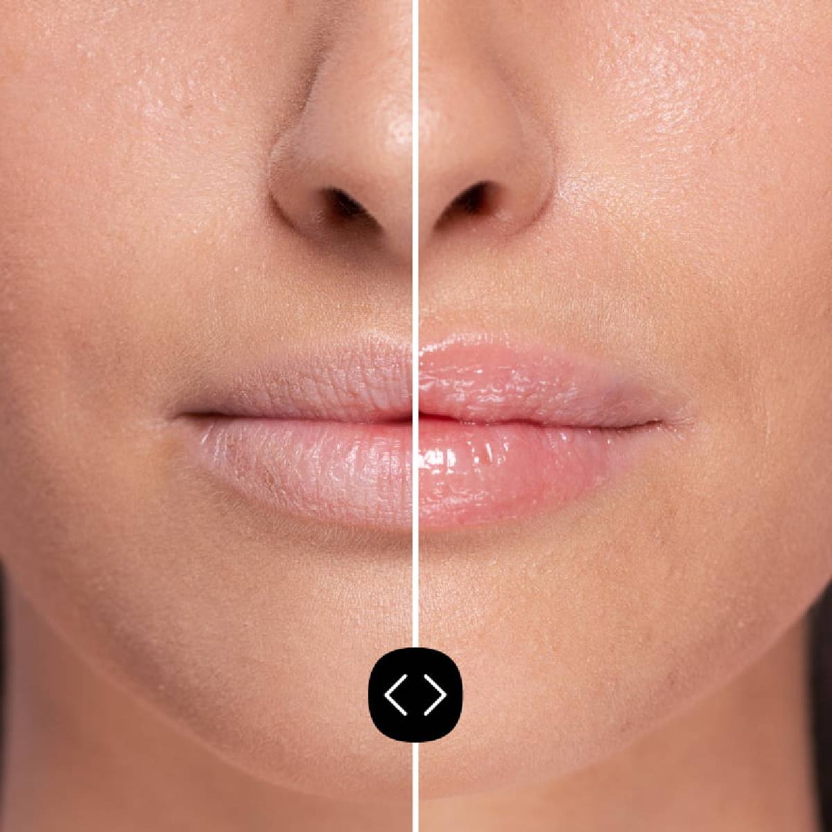 Freshly Hyaluronic Lip Volumiser 5 ml