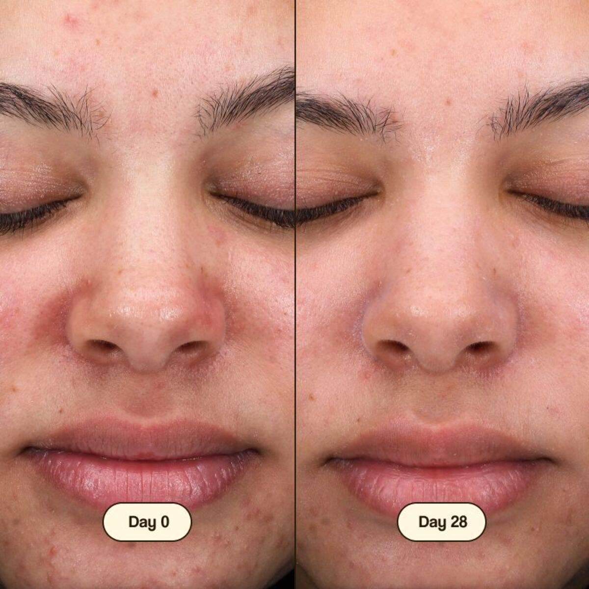 Salicylic Fresly gezichtsreiniger 100 ml