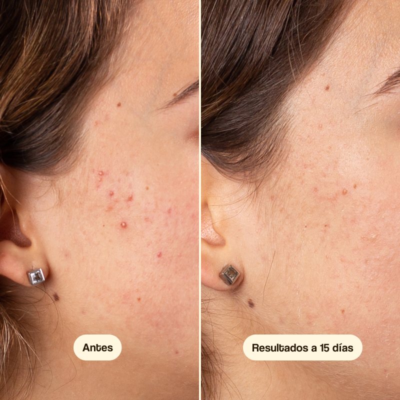 Crème visage Azelaic Radiance Face Serum Freshly 50 ml