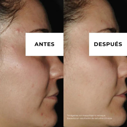 Equilibrium crème tegen acne voor de vette huid Arganour 30 ml