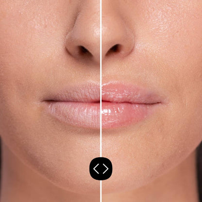 Freshly Hyaluronic Lip Volumiser 5 ml